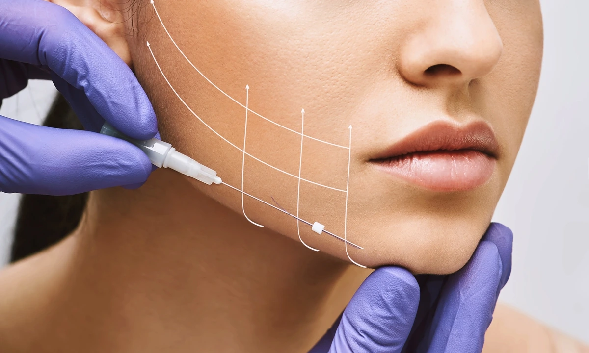 زاویه سازی (کانتورینگ)